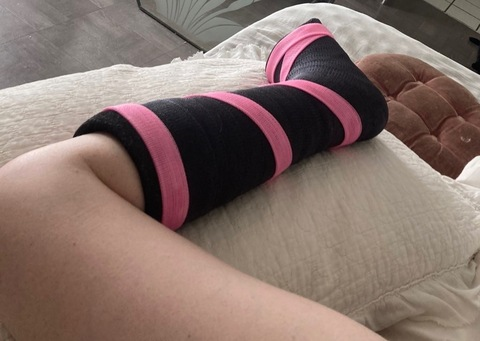 brokenankle93 onlyfans leaked picture 1